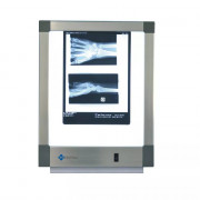 Négatoscope extra-plat – Écran 36 x 43,5 cm Négatoscope extra-plat – Écran 36 x 43,5 cm