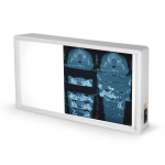 Négatoscope GIMA à 1,5 plages