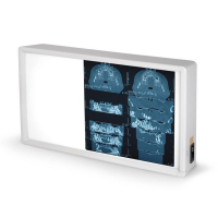 Négatoscope GIMA à 1,5 plages Négatoscope GIMA à 1,5 plages