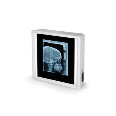 Négatoscope GIMA à 1 plage Négatoscope GIMA à 1 plage