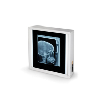 Négatoscope GIMA à 1 plage Négatoscope GIMA à 1 plage