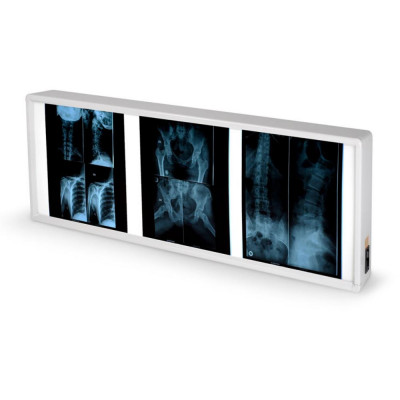 Négatoscope GIMA à 2 plages Négatoscope GIMA à 2 plages