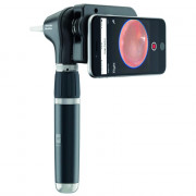 Otoscope Welch Allyn MacroView™ 2 plus IXAMINER Otoscope Welch Allyn MacroView™ 2 plus IXAMINER